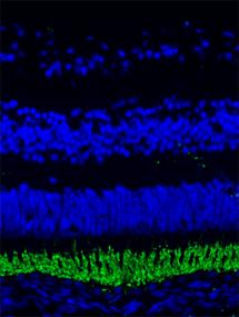 Fluorescence Microscopy of the Newborn Macula