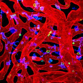 2020-Vector-Photo-Contest_Mullins-Lab-Submission_Confocal-Projection_Human-Choroid_UEA-CD45-Iba1 2020-Vector-Photo-Contest_Mullins-Lab-Submission_Confocal-Projection_Human-Choroid_UEA-CD45-Iba1
