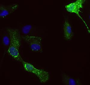 Rab5a-Positive Endosomes in RF/6A Cells