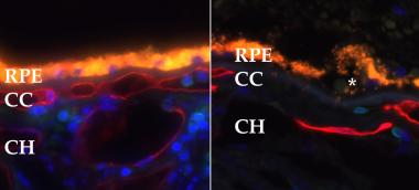 Labeling of healthy blood vessels (red) in a healthy eye (left) and an eye with geographic atrophy (right). Note the loss of choriocapillaris vessels (CC) in the eye with geographic atrophy.