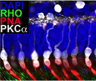 Retinal Organ Culture. Photo courtesy of Dr. Luke Wiley.